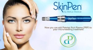 Microneedling with Platlet Rich Plasma