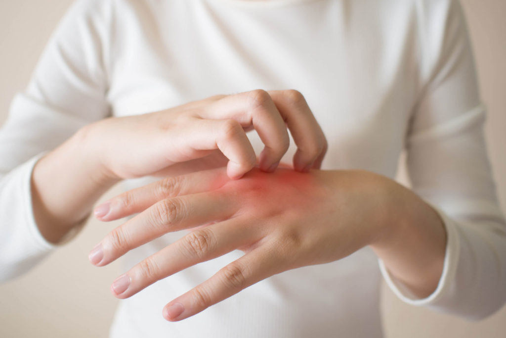 Can Frequent Handwashing Trigger Hand Eczema? - Pariser Dermatology