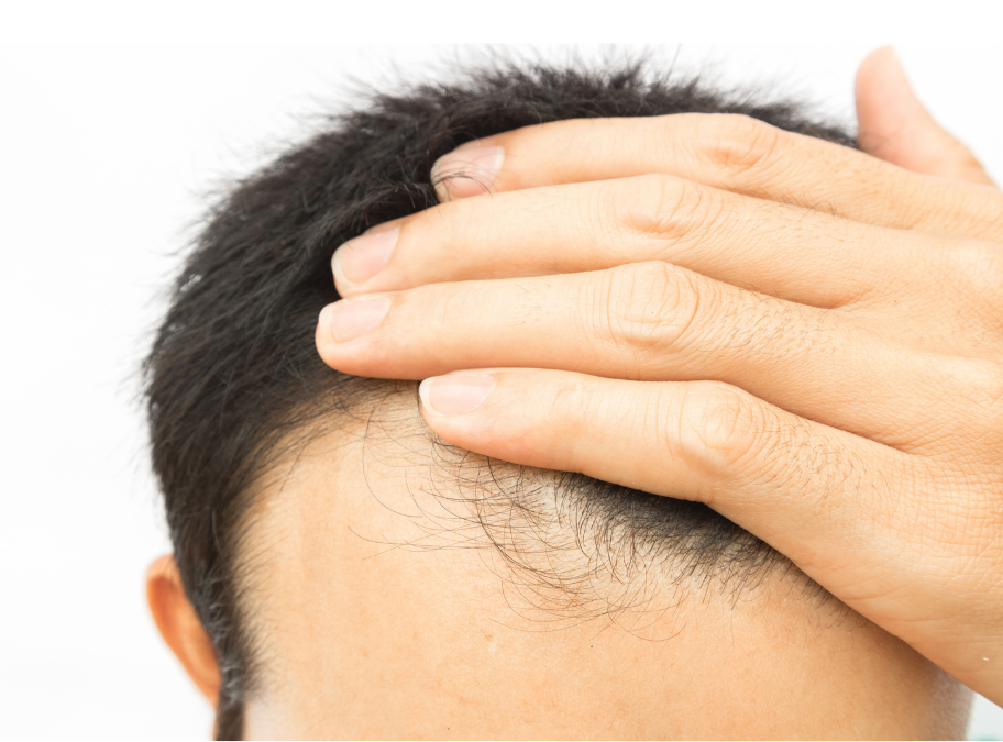 Dermatologist testing red light hair comb